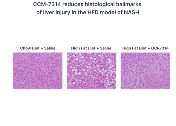 CCM-7314 reduces histological hallmarks of liver injury in the HFD model of NASH